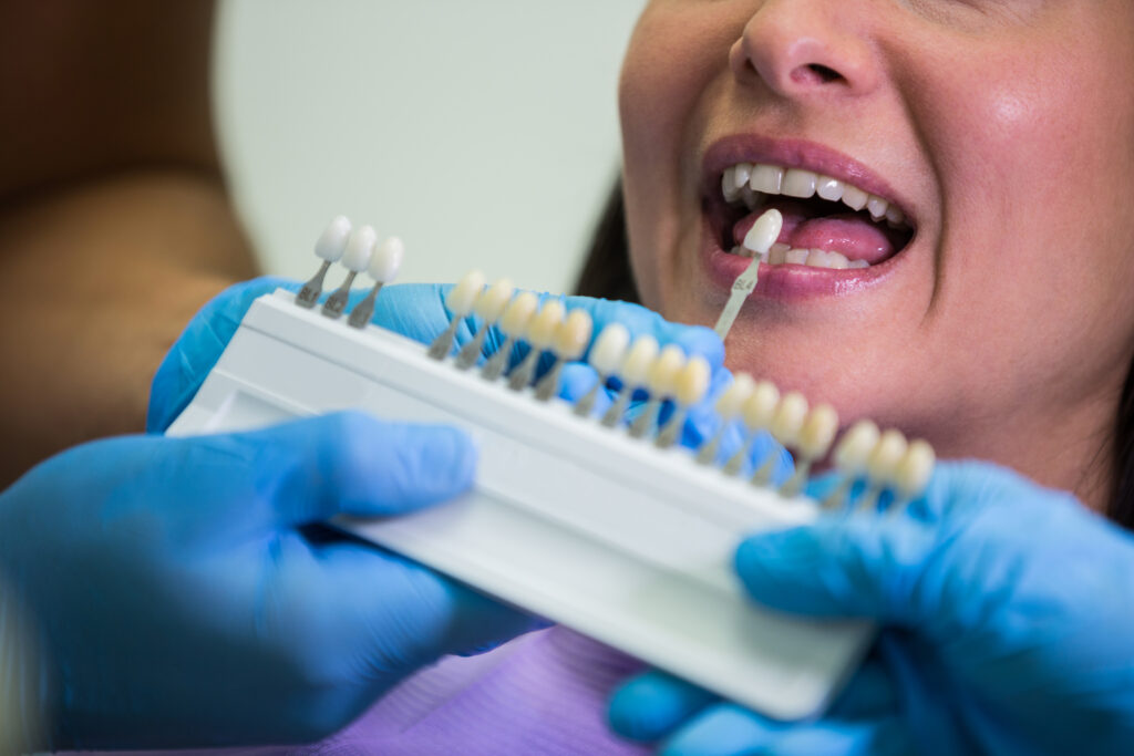 dentist examining female patient with teeth shades at dental clinic